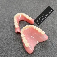 ساخت دندان مصنوعی سرامیکی دریک روز|آرایشی، بهداشتی، درمانی|زابل, |دیوار