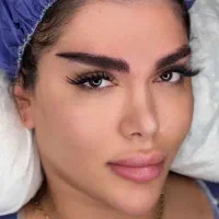 کاشت ابرو به روش میکروکاشت 9/500