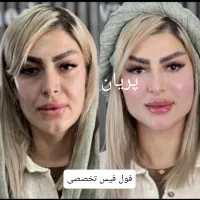جشنواره تخفیف فیلر فول فیس ژل بوتاکس نخ هایفو|خدمات آرایشگری و زیبایی|مشهد, فرهنگ|دیوار