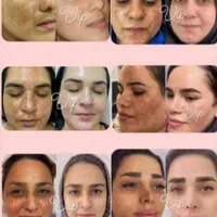 تنهاکرم وی ای پی اصل دراستان کهگلویه وبویراحمد|آرایشی، بهداشتی، درمانی|دهدشت, |دیوار