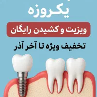 ایمپلنت تخصصی از ۷میلیون+ اوردنچر/ تخفیف تاآخرآذر