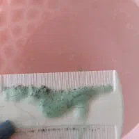 پاکسازی شپش و رشک