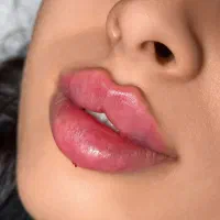 جشنواره تخفیفات ژل و بوتاکس