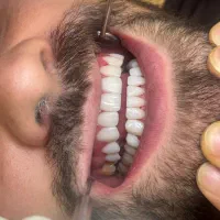 دستیار دندانپزشکی