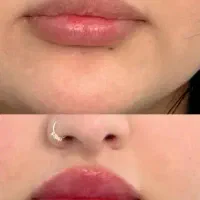 تخفیف تزریق فقط یک هفته