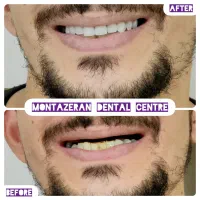 دندانسازی دندانساز دندان مصنوعی دندان باضمانت|آرایشی، بهداشتی، درمانی|مشهد, کوشش|دیوار