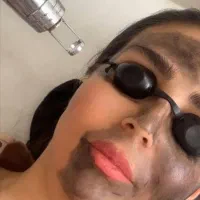 پاک کردن تتو،برداشتن خال،بوتاکس،فیلر،ژل|خدمات آرایشگری و زیبایی|کرج, گوهردشت|دیوار