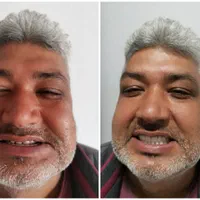 تعمییر وساخت دندان مصنوعی 10 میلیون|خدمات آرایشگری و زیبایی|تنکابن, |دیوار