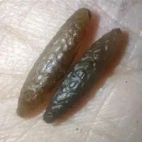 مهره شرط کار اول نتیجه بعد هزینه