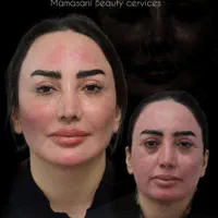 مطب زیبایی و لیزر با ده سال سابقه (فلکه جهاد)|خدمات آرایشگری و زیبایی|نورآباد ممسنی, |دیوار
