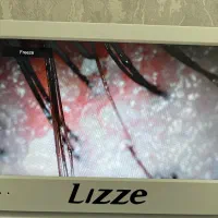 پاکسازی کف سر و پاکسازی صورت