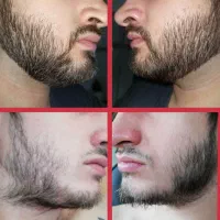 ریشات پرپــشت میشه