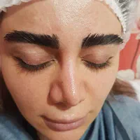 لیزر، بلفارو، تزریق چربی، تخلیه شکم ،ژل بوتاکس نخ