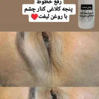 روغن رفع چین چروک|آرایشی، بهداشتی، درمانی|حمیدیا, |دیوار