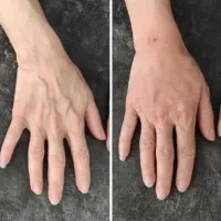 آموزش و خدمات فیلر بادی باسن بیکینی دست و پا|خدمات آرایشگری و زیبایی|قم, زنبیل آباد|دیوار