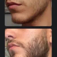 ریش و سیبیل پر
