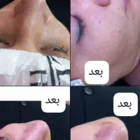 سالن زیبایی آی نیل با قیمت منصفانه|خدمات آرایشگری و زیبایی|خرمآباد, |دیوار