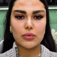 جشنواره ژل لب فیلربوتاکس لیفت صورت کانتورینگ آنزیم