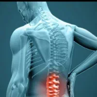 دیسک کمر،سیاتیک،شکسته بند