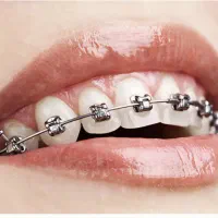 استخدام دستیار دندانپزشک مسلط به ارتودنسی ، پیروزی