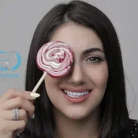 اقساط زیبایی ایمپلنت لمینیت کامپوزیت سجاد بهارستان