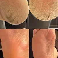 آف اموزش و خدمات پدیکور و لیفت و لمینت کاشت مژه
