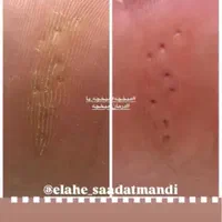 خدمات پودولوژی و پدیکور درمانی ، تخلیه میخچه و ..|خدمات آرایشگری و زیبایی|تهران, فردوس|دیوار