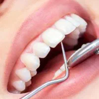 دستیار دندانپزشک آقا وخانم