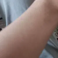 اپلاسیون در خانه