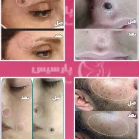 پلاسما وفیان ومزونیدل کرم پودر دائم