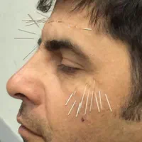 حجامت.زالودرمانی.فصدخون|خدمات آرایشگری و زیبایی|اسلامشهر, شهرک مهدیه|دیوار