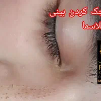 پلاسما تراپی خانم و آقا