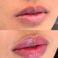 چند مدل برای فیلر هزینه مواد گرفته میشود