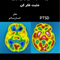 روانشناس و نوروتراپیست|خدمات آرایشگری و زیبایی|اصفهان, شمس آباد|دیوار