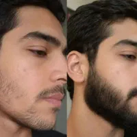 کاکو بدون ریش کنسله