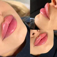 کلینیک ژل لب روسی و بوتاکس و آنزیم فیلر مطب پزشک|خدمات آرایشگری و زیبایی|کرج, گوهردشت|دیوار
