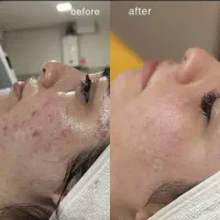 فیشیال وپاکسازی تخصصی فقط با ۳۸۰هزار تومان‌
