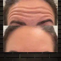 کرم رفع چین و چروک صورت|آرایشی، بهداشتی، درمانی|تبریز, |دیوار