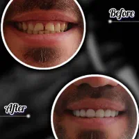 دندانپزشکی اقساطی باارائه وام و با کیفیتی استثنایی|خدمات آرایشگری و زیبایی|شیراز, ملاصدرا|دیوار