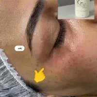 آف دو روزه
