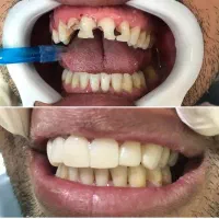 دندان پزشکی|خدمات آرایشگری و زیبایی|کرمانشاه, |دیوار