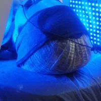 فیشیال درمانی