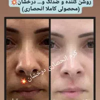 کرم چند کاره درخشان کاملا انحصاری و بدون بازگشت|حراج|خرمآباد, |دیوار