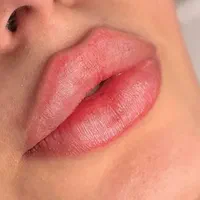 جشنواره تابستانه مطب پزشک زیبایی|خدمات آرایشگری و زیبایی|شیراز, ابیوردی|دیوار