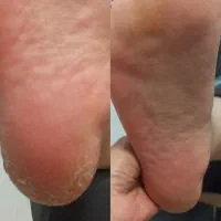 پدیکور پا|خدمات آرایشگری و زیبایی|بروجرد, |دیوار