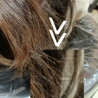 موخوره گیری بدون کوتاهی