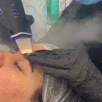 فیشیال و پاکسازی تخصصی صورت با تخفیفات یلدایی