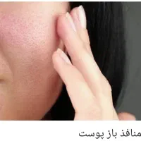خدمات وآموزش فیشیال حرفه ای.