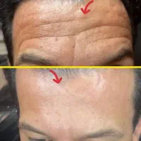 کرم بیوممتیک