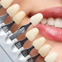 تخفیف محدود و ویژه خدمات دندانپزشکی|خدمات زیبایی و سلامت|تهران, صاحب الزمان|دیوار